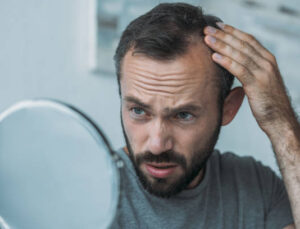 Saç Dökülmesine Karşı Uyarı: “Stres ve Yaşam Tarzı Etkisi Artıyor!”