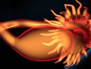 Aort damarındaki problemler tüm vücudu etkiliyor