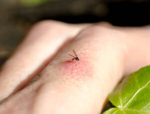 Küba’da sivrisinek ısırıklarından 33 kişi öldü
